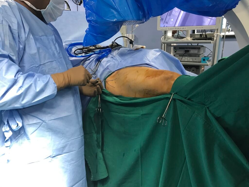 Hip Joint Arthroscopy
