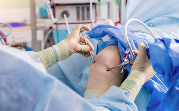 ACL Surgery