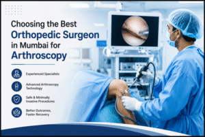How Do You Choose the Best Orthopedic Surgeon in Mumbai for Arthroscopy?